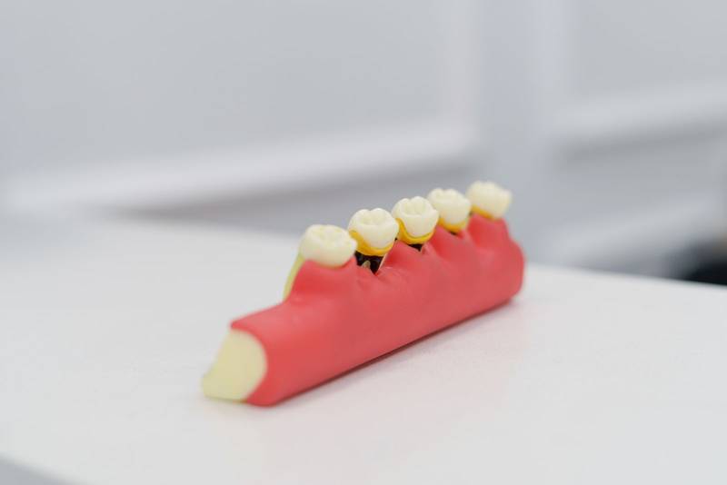 denture piece with molars and gum